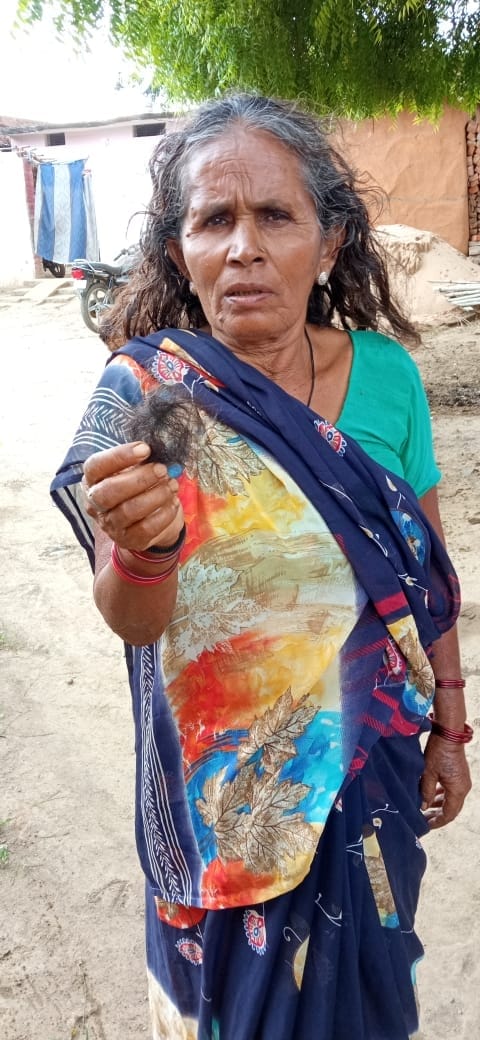 Old woman beaten up, accused of plucking her hair
