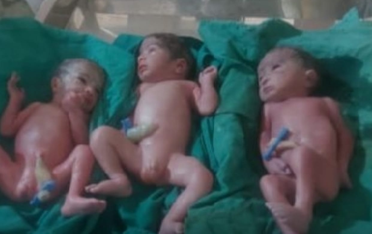 Woman gave birth to three children at once
