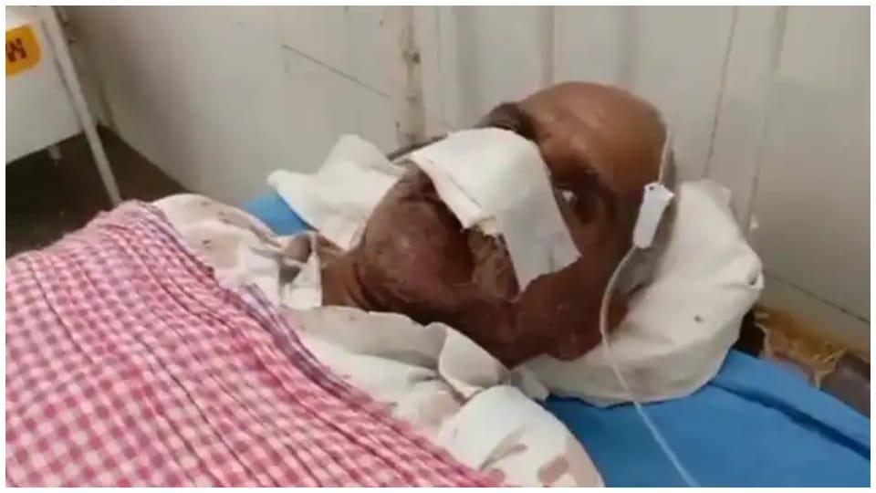 Daughters Father Beaten Up For Breaking Engagement Nose Cut In Barmer