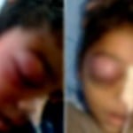 छात्र का अहमदाबाद में चल रहा था इलाज।