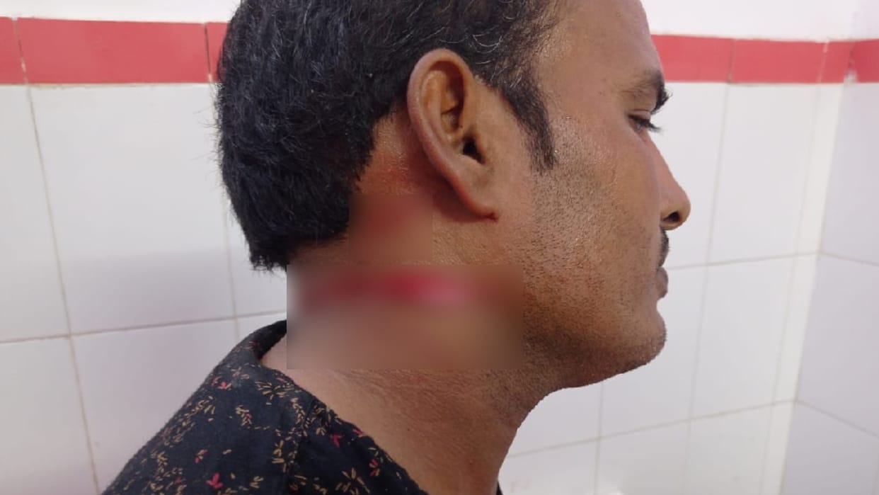 shopkeeper brothers attacked with sharp weapons