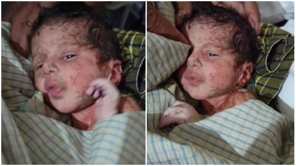 Newborn Baby Girl Found In Thorn Bushes Churu Rajasthan