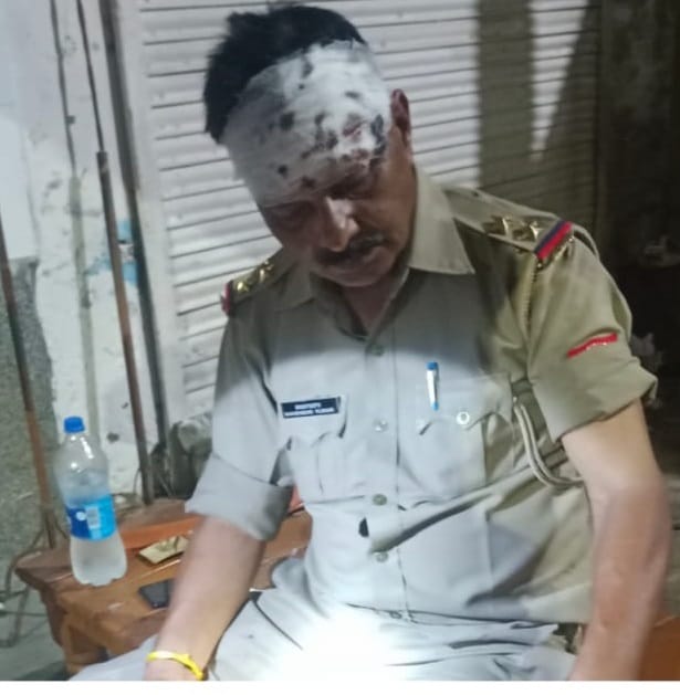 Tanker hit police jeep, police officer injured