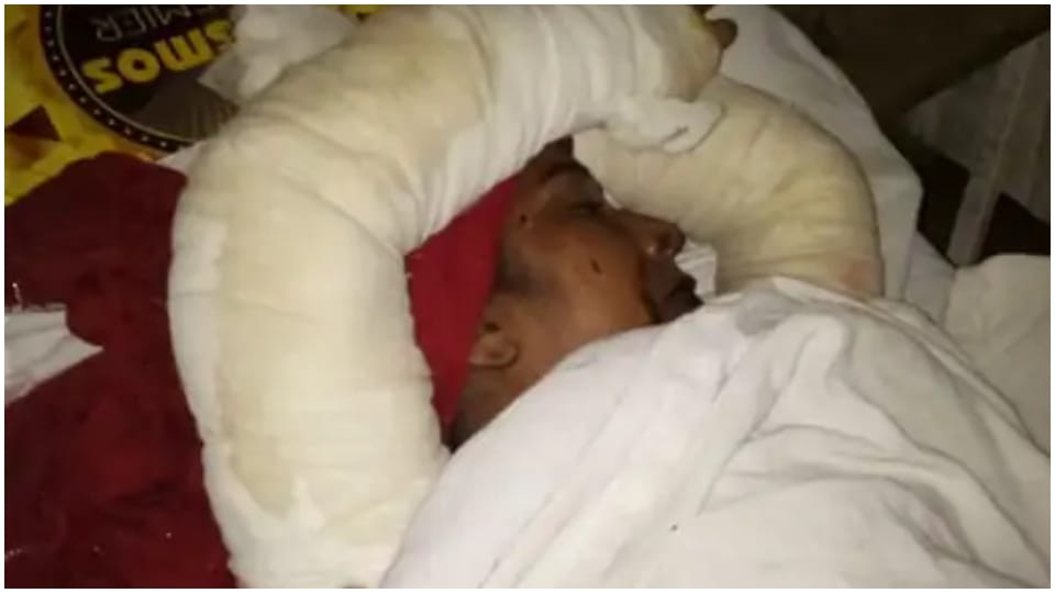 Dalit Woman Teacher Burnt Alive In Jaipur Rajasthan