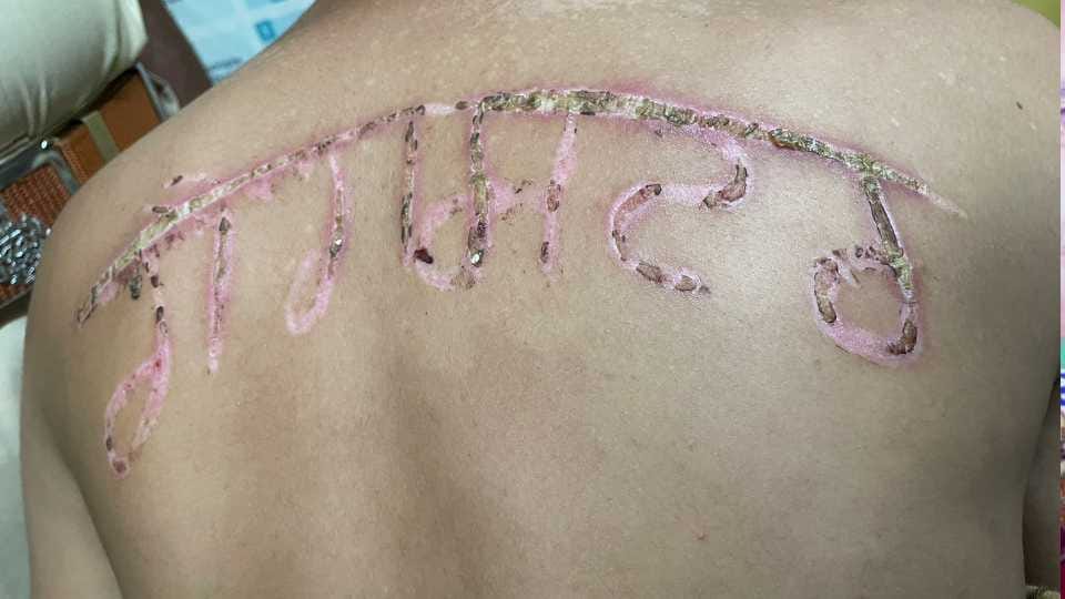 Punjab Police accused of writing gangster on prisoner's back