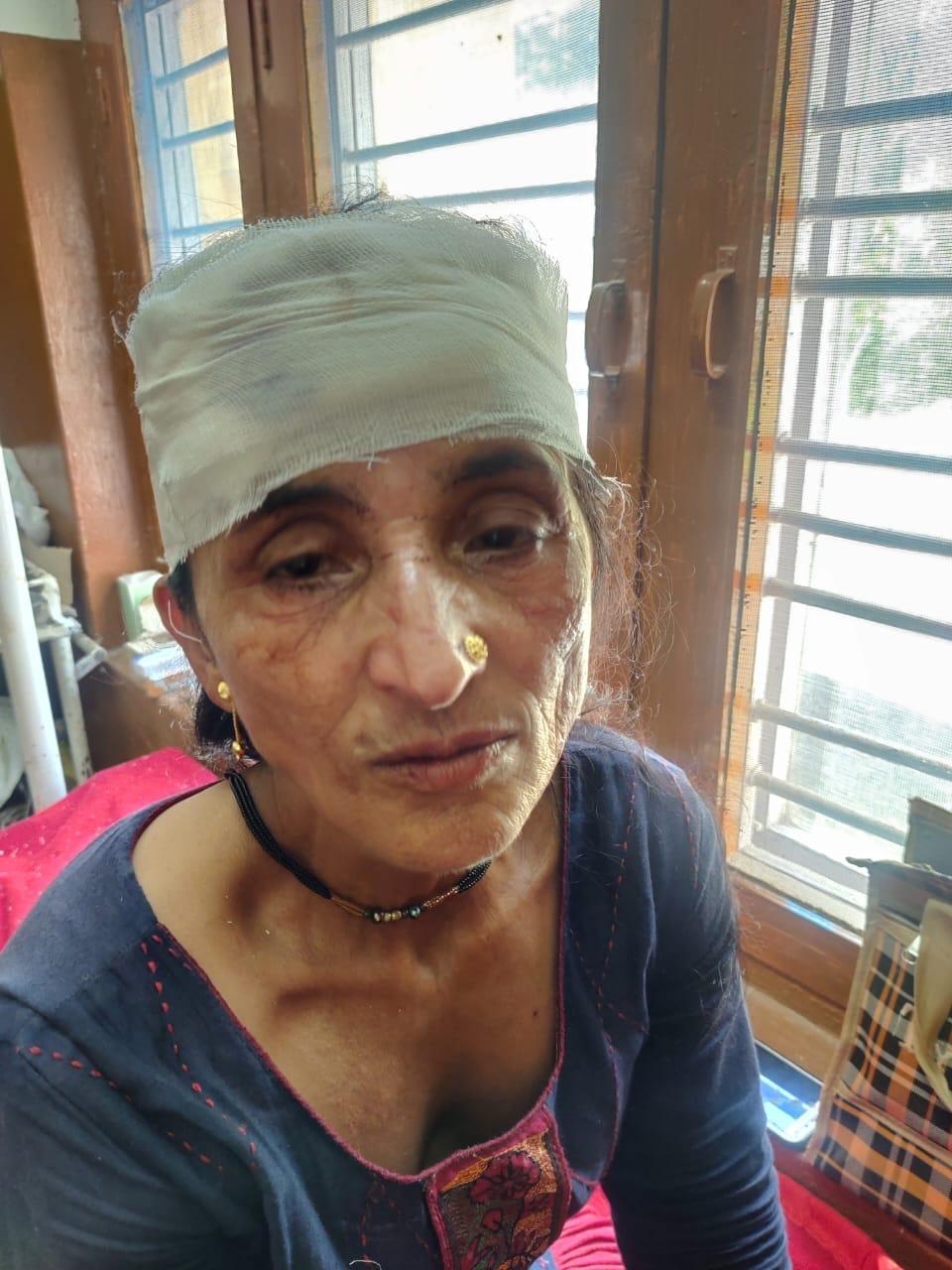 woman falldown in landslides in bhadidhar silai and injured