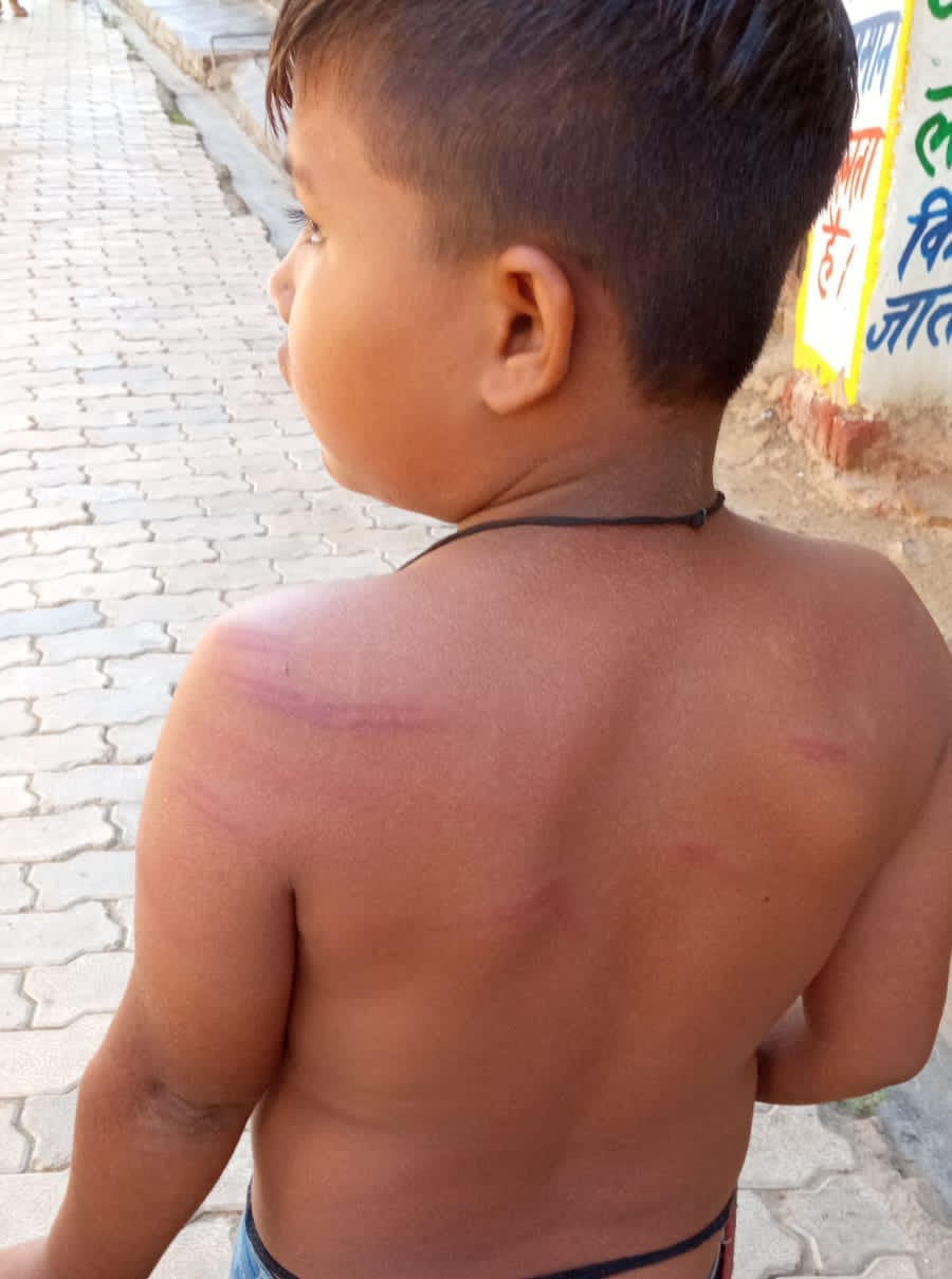 The headmaster beat up a class four student