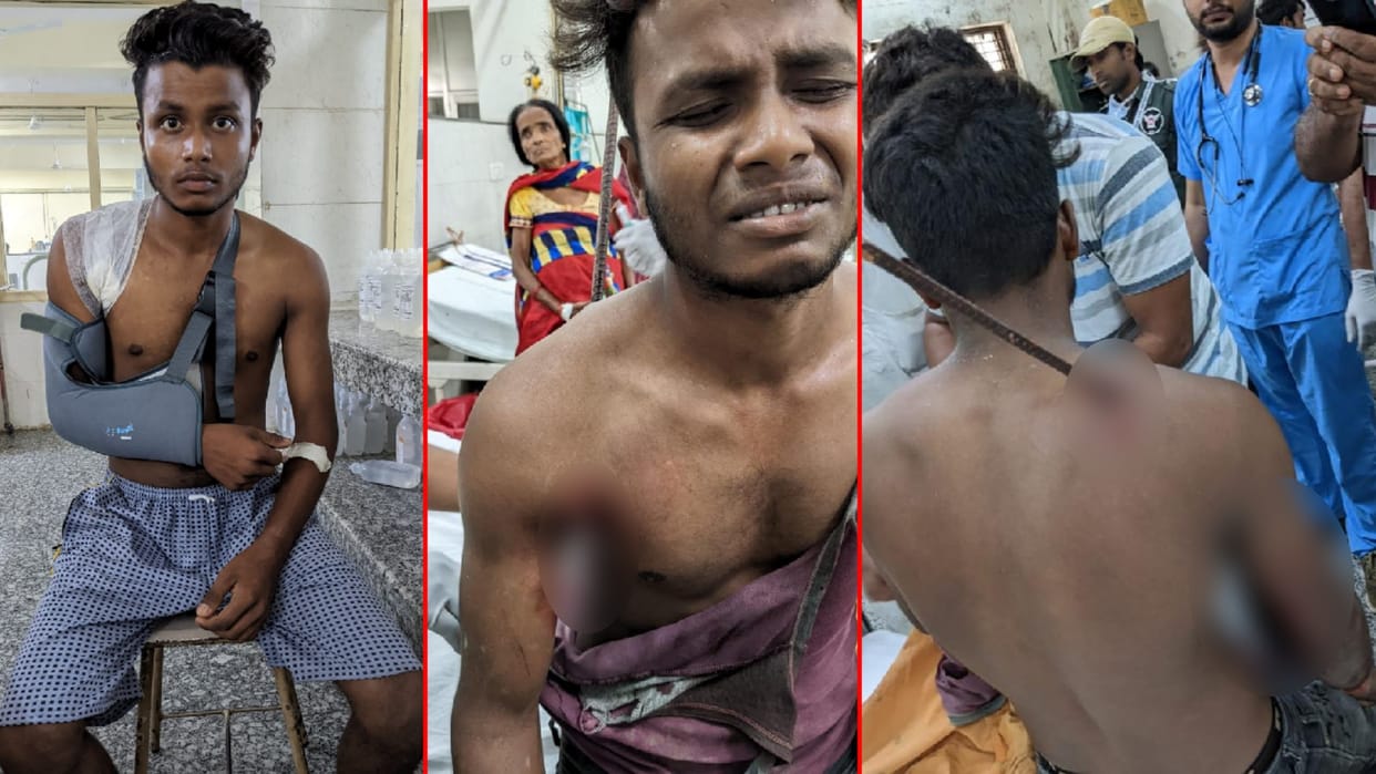 barbed crosses shoulder of laborer saved his life by doing surgery