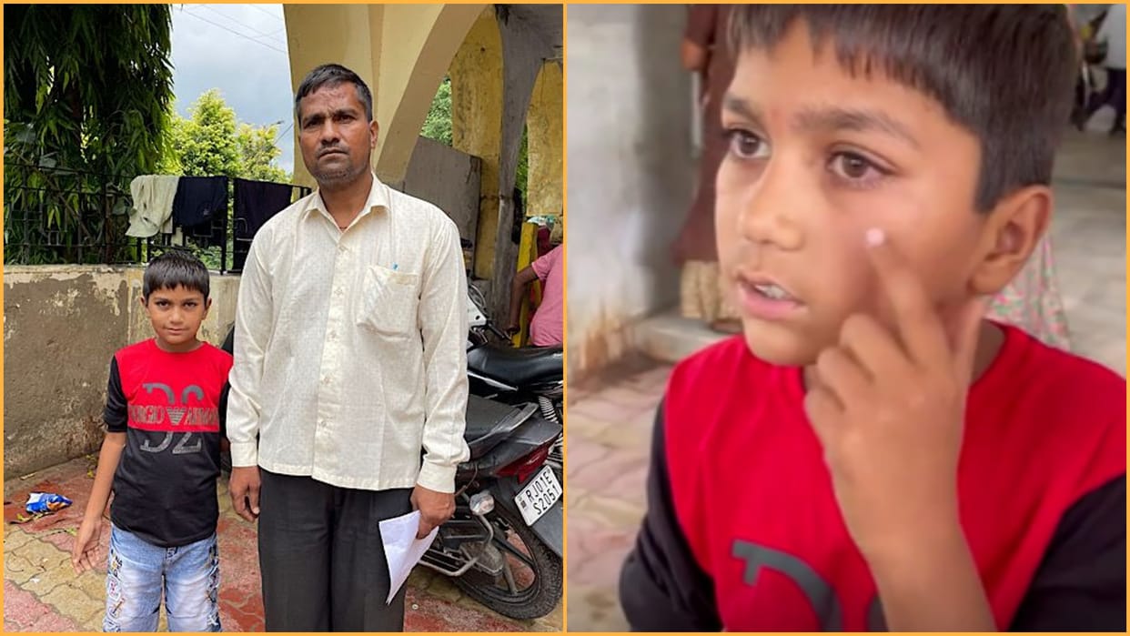 teacher beaten student in Ajmer child eye sight effected