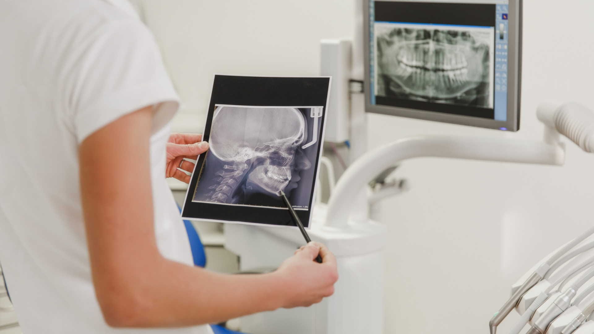 treacher collins syndrome symptoms causes and life expectancy, kno details in hindi