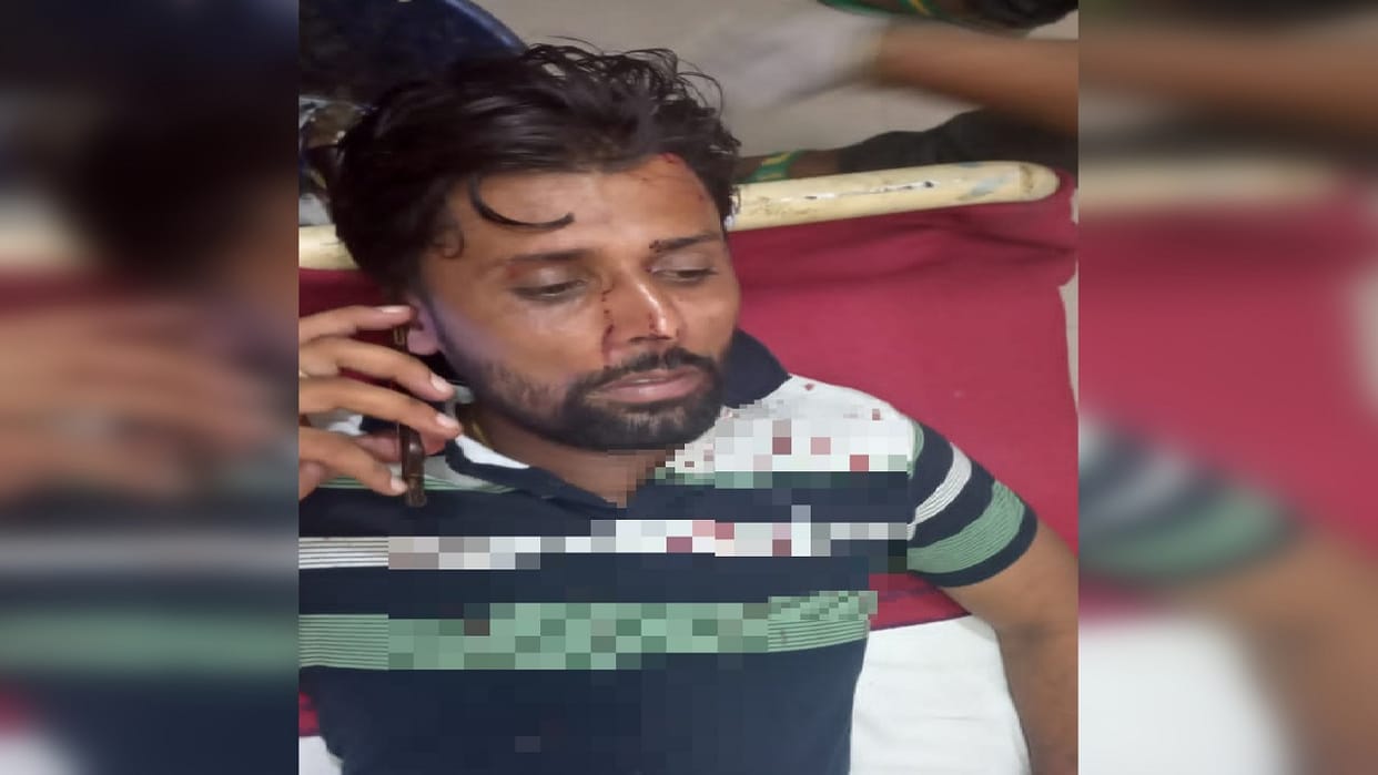 village head injured as he shot in Baraut area of Baghpat one arrested