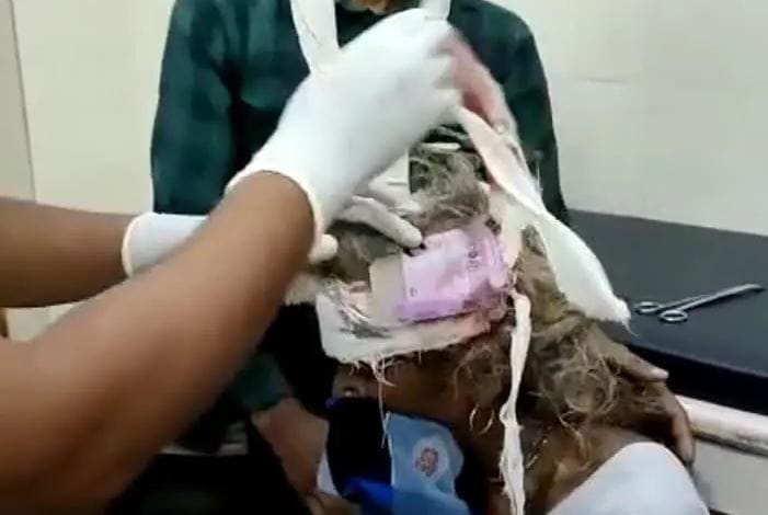 रुई की जगह कंडोम के रेपर लगाकर ड्रेसिंग