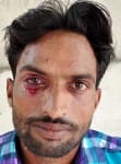 घायल पोलर लोकेंद्र कुमार।