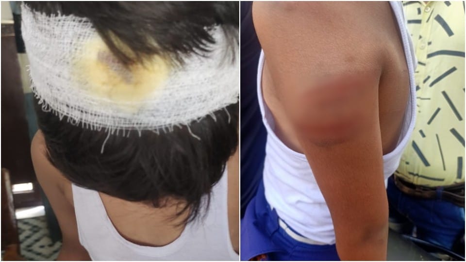Student brutally beaten up by private school teacher in Agra