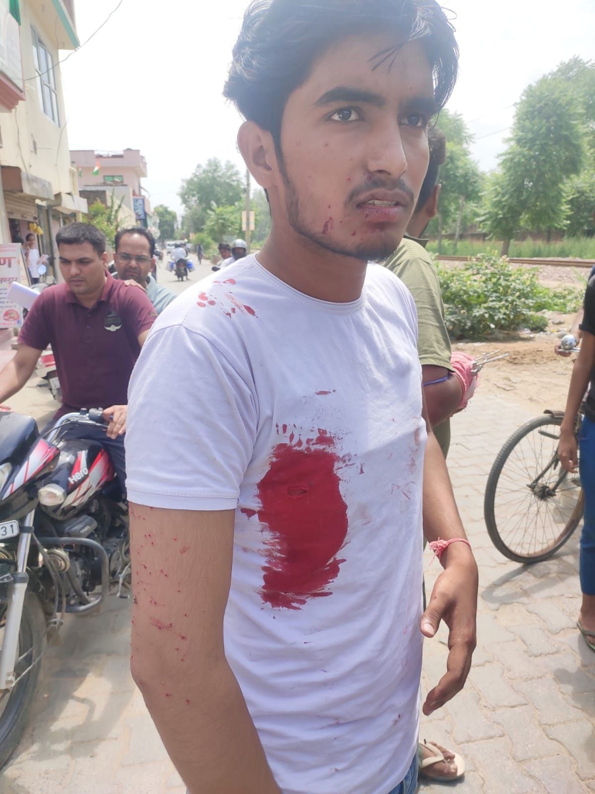 Class 12 student shot at by two bike-borne youths