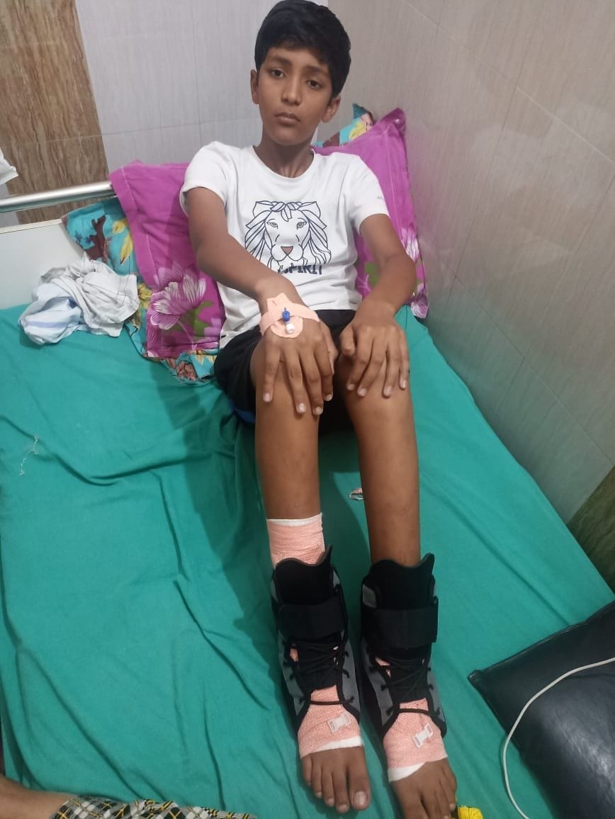 The child jumped from the roof after being surrounded by monkeys, both legs were broken