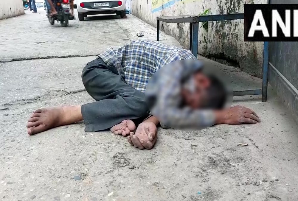 Haridwar District Hospital: Driver drive Rickshaw toto emergency after not get stretcher for patient