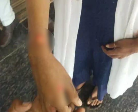Attempt to kidnap by assaulting a rape victim who was going to give statement in court in Sehore