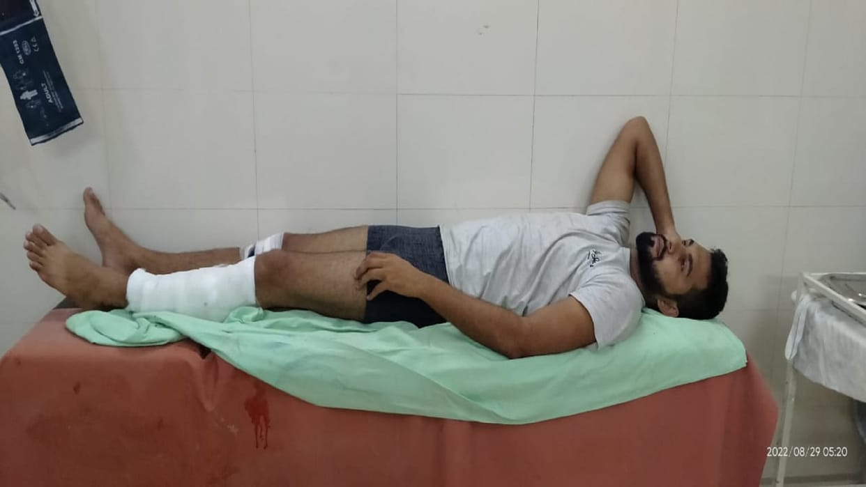 Four robbers arrested in encounter one was shot robbery exposed in Katra and Soraon