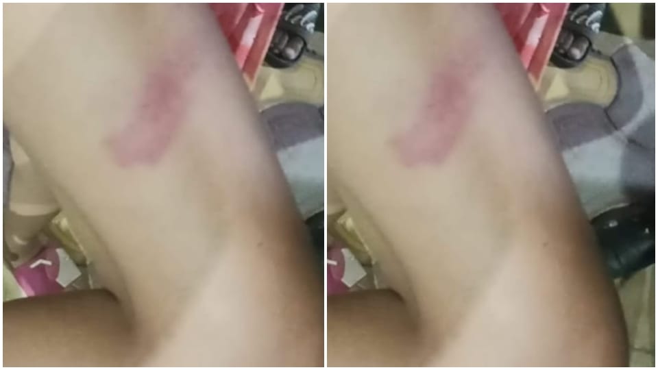 School Teacher Beat Up 12 year Girl In Bikaner News