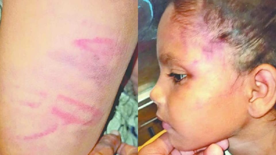 Teacher beat up two innocent sisters with sticks for not doing homework