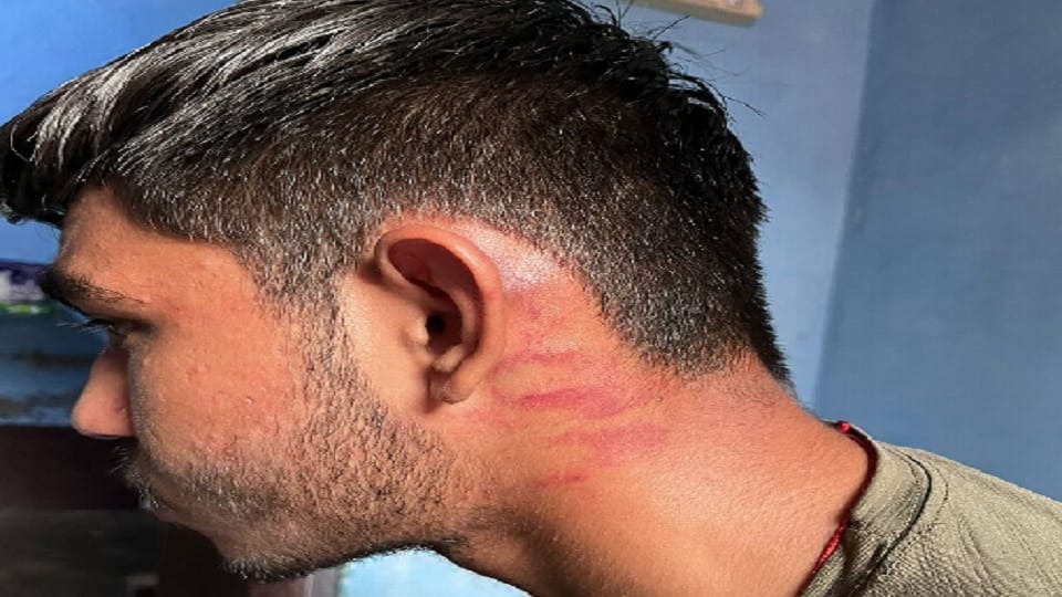 Teachers beat up tenth student in DAV Public School, ear veil torn in hapur