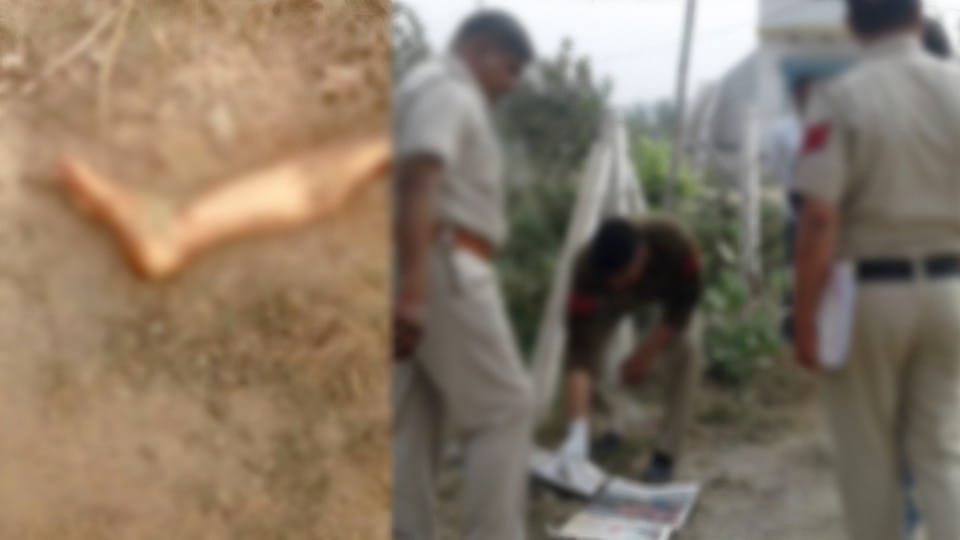 Chhindwara: Sensation after getting chopped leg near small pond, dogs were scratching