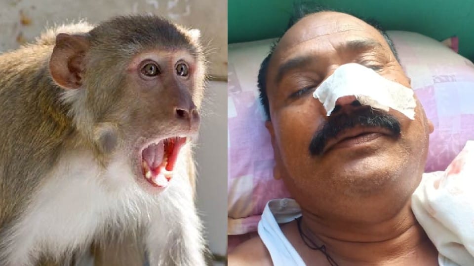 Chhatarpur: Monkeys attack police station, head constable's nose cut off, constable's leg