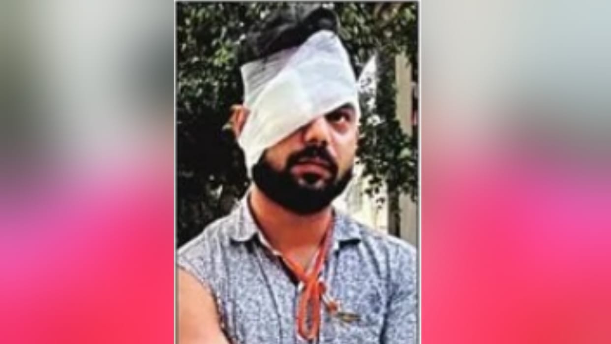 The auto driver broke the eye of the car-riding doctor IN ghaziabad