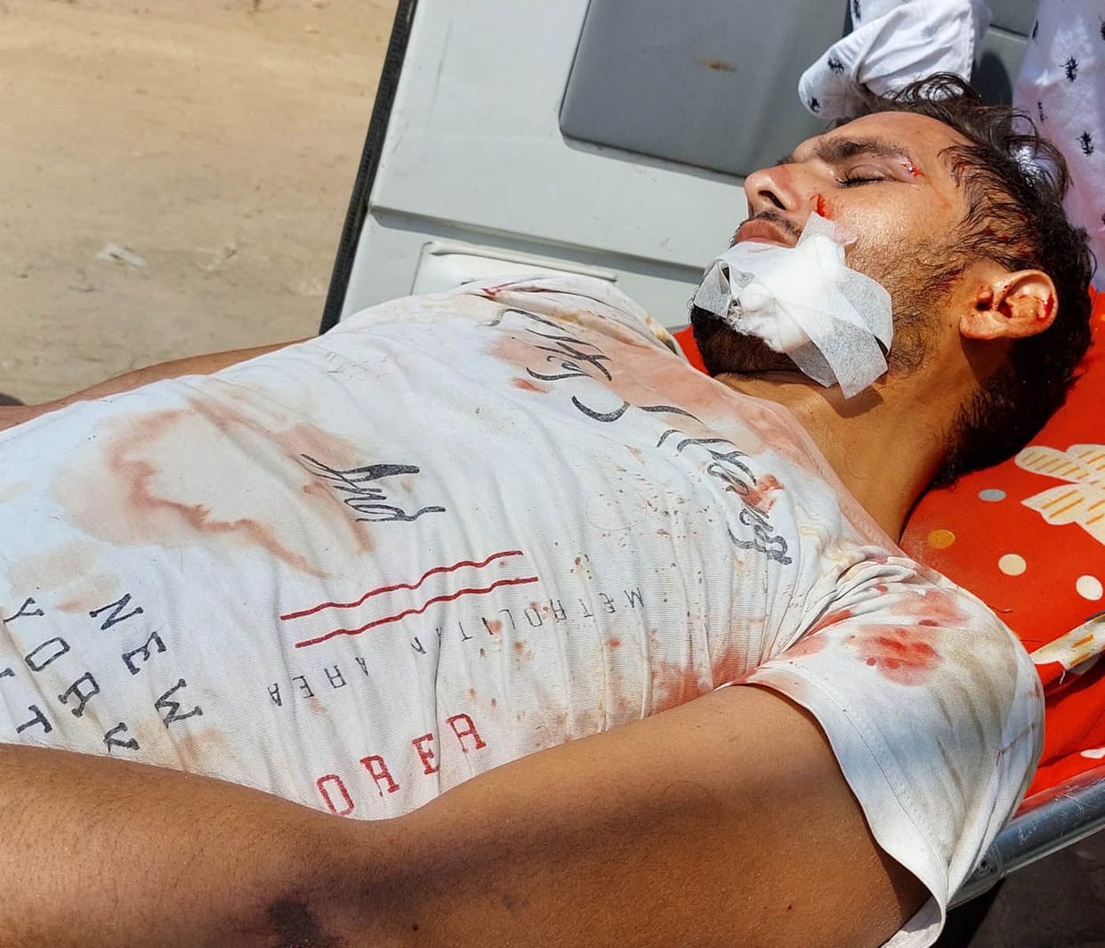 Bike rider's leg fractured due to car collision