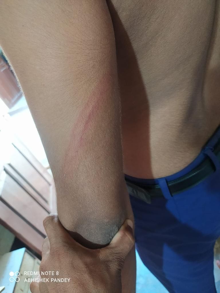 allegation of beaten student