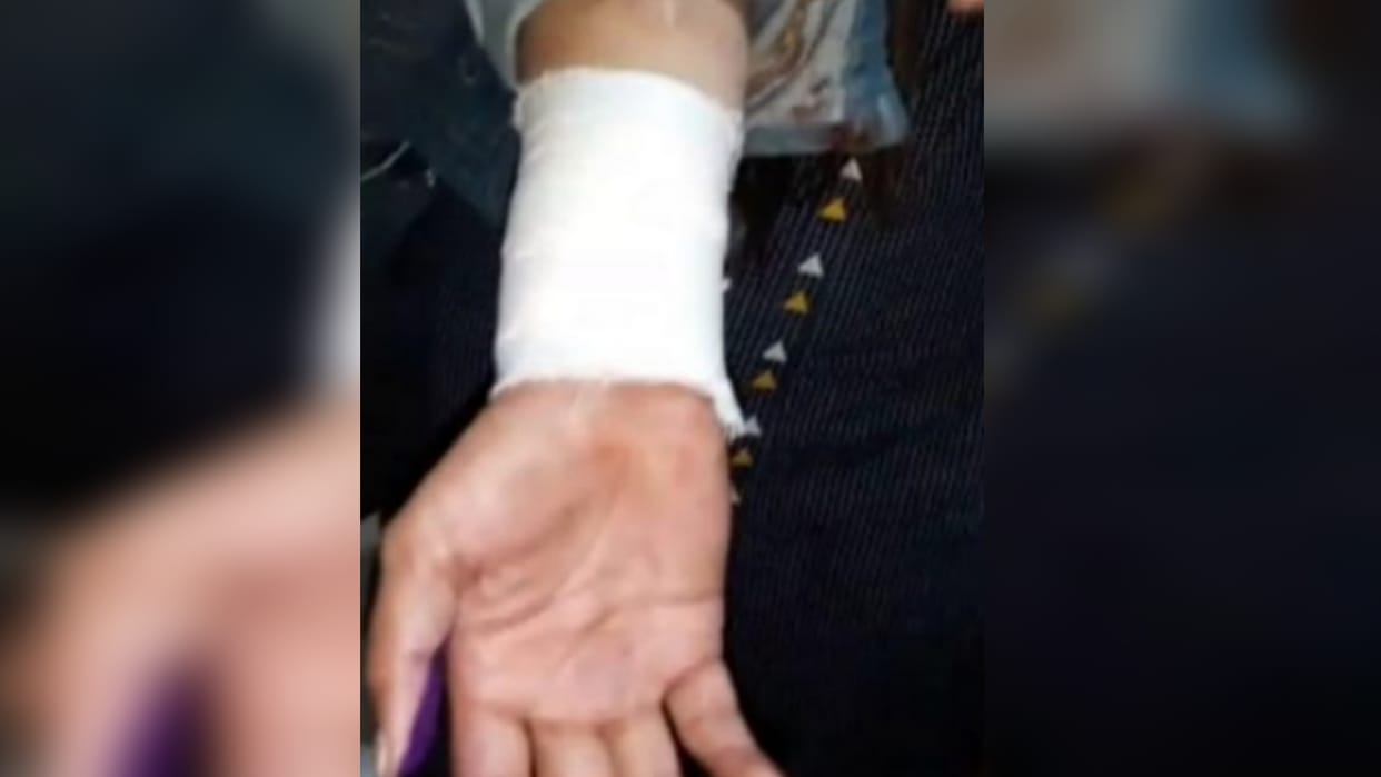 UP: Sexualy assaulted victim cut her arm vein outside DIG office in Saharanpur