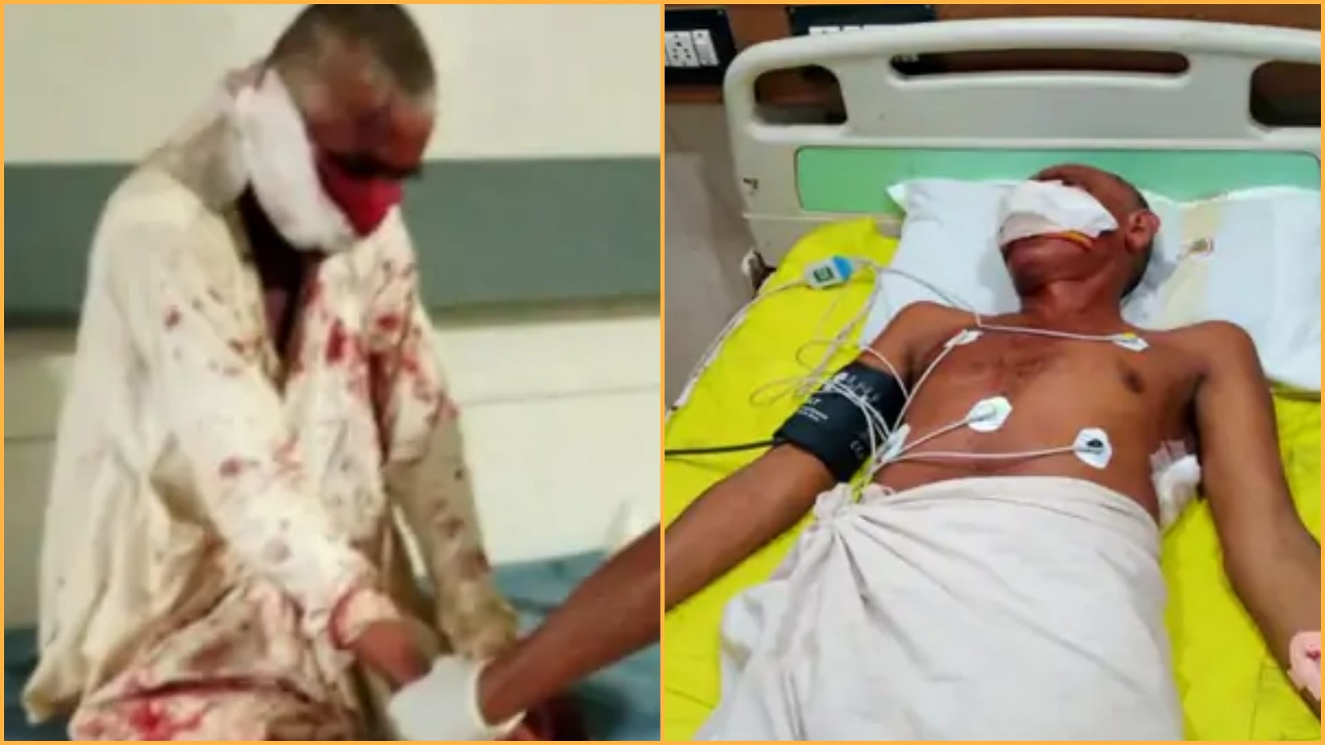 14 year old daughter fight with bear to save father in Sirohi