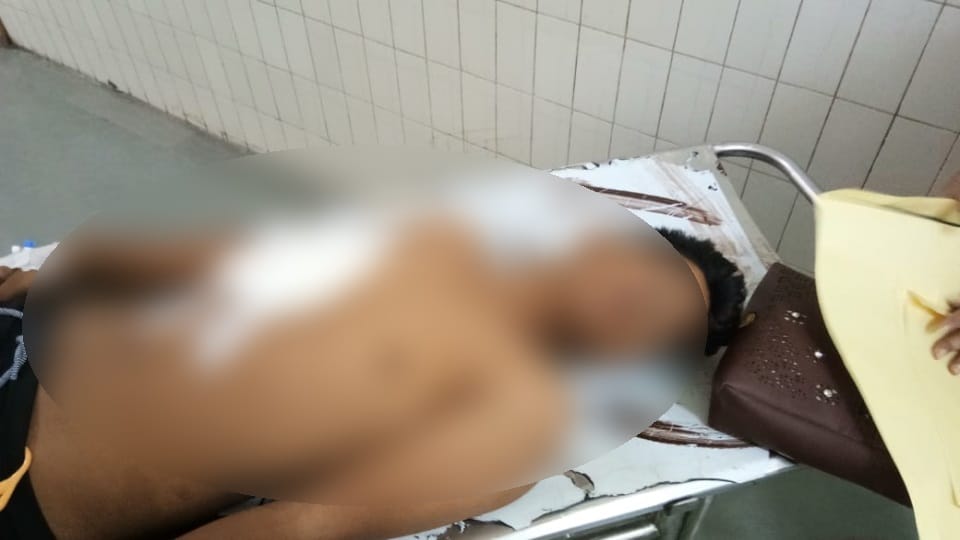 Uttarakhand News: Five children scorched due to grip by high tension line in haldwani