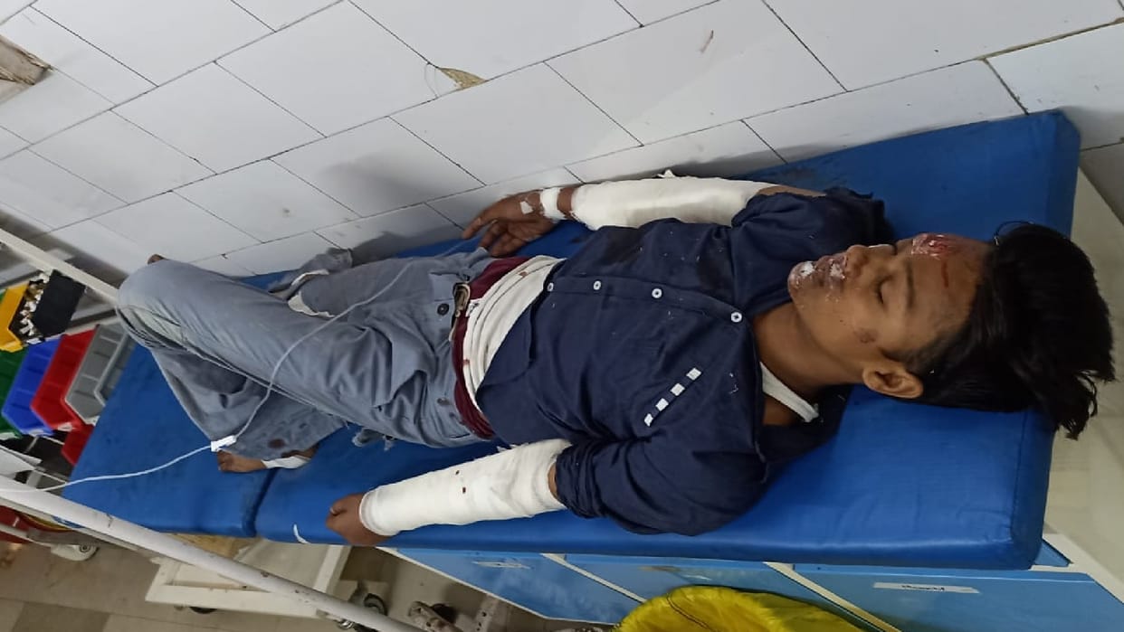Two bikeriders injured after fell from Thakurdwara flyover Ghaziabad
