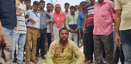Bjp Mandal President and Home Guard clash in MCH wing
