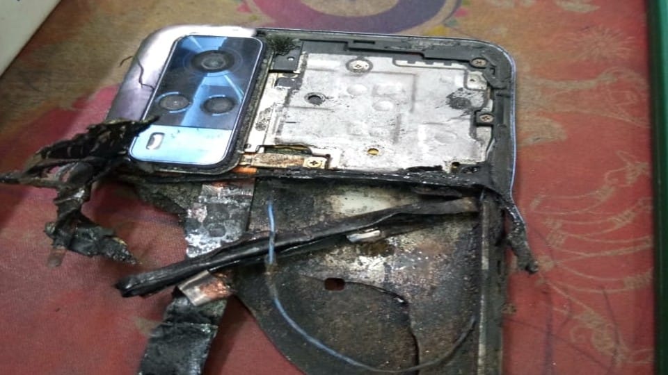 Mobile Blast While playing the game mobile exploded in the hand of the child badly scorched