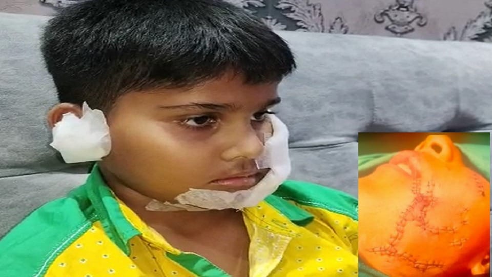 Pitbull dog attacked child in Sanjay Nagar Sector 23 of Ghaziabad survived after surgery