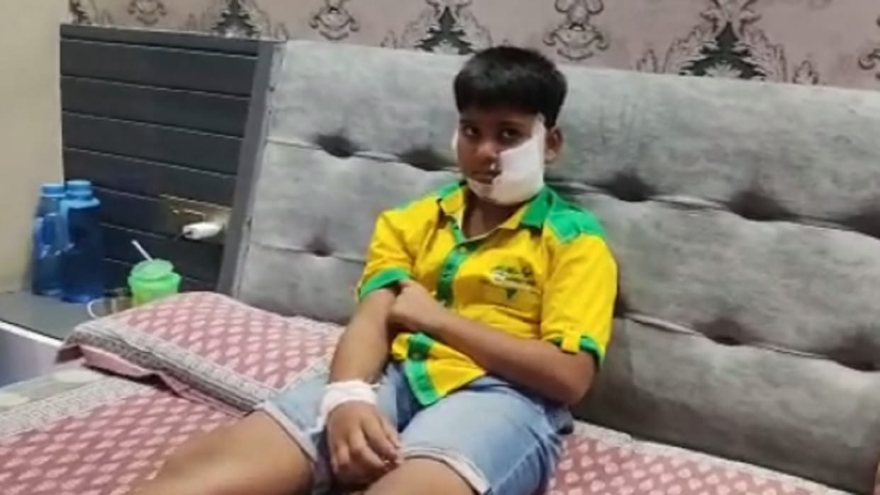 Ghaziabad Pitbull Owner Fined Five Thousand, Injured Kush Will Not Go to School for a Month