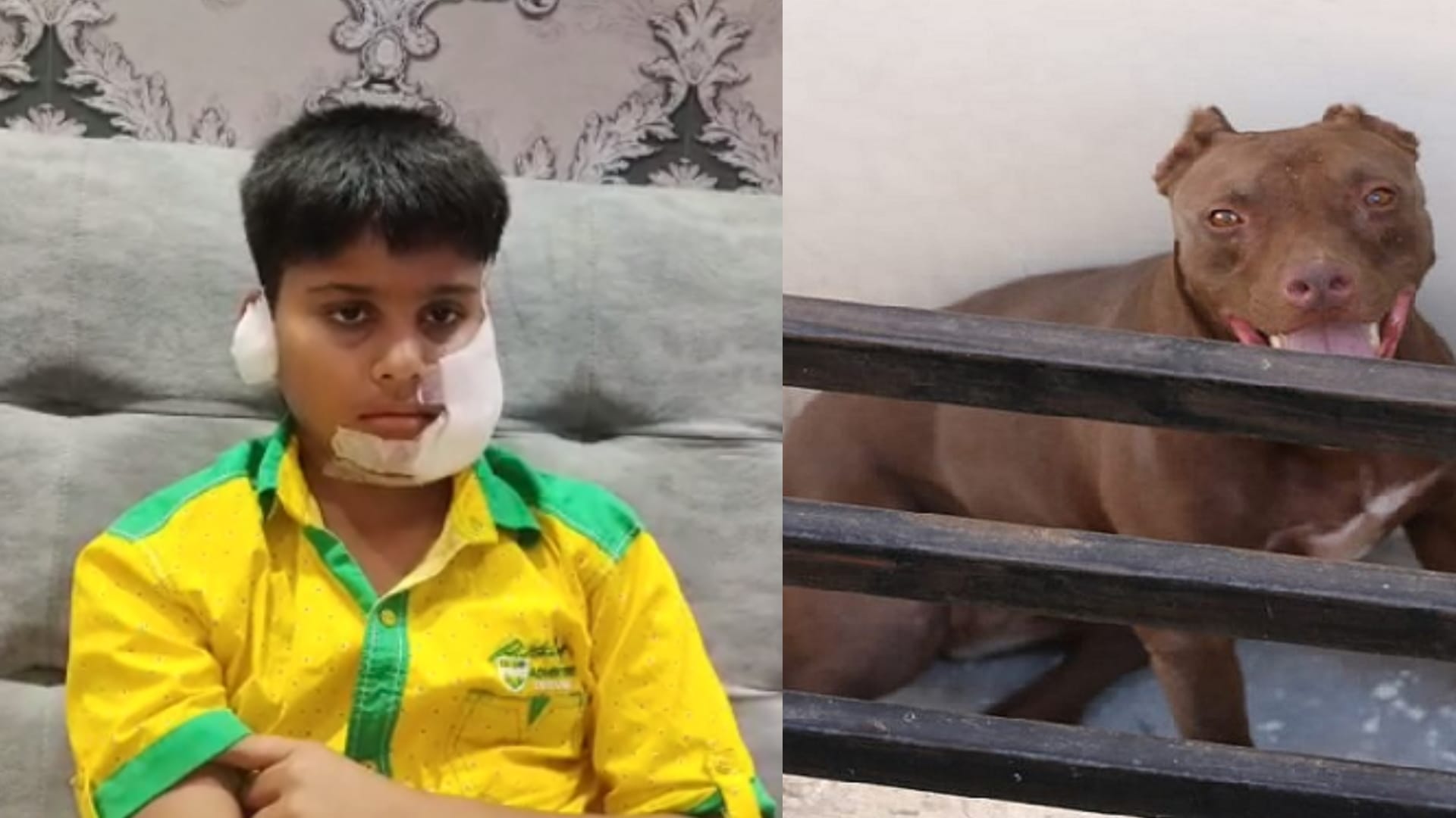 Ghaziabad Pitbull Owner Fined Five Thousand, Injured Kush Will Not Go to School for a Month