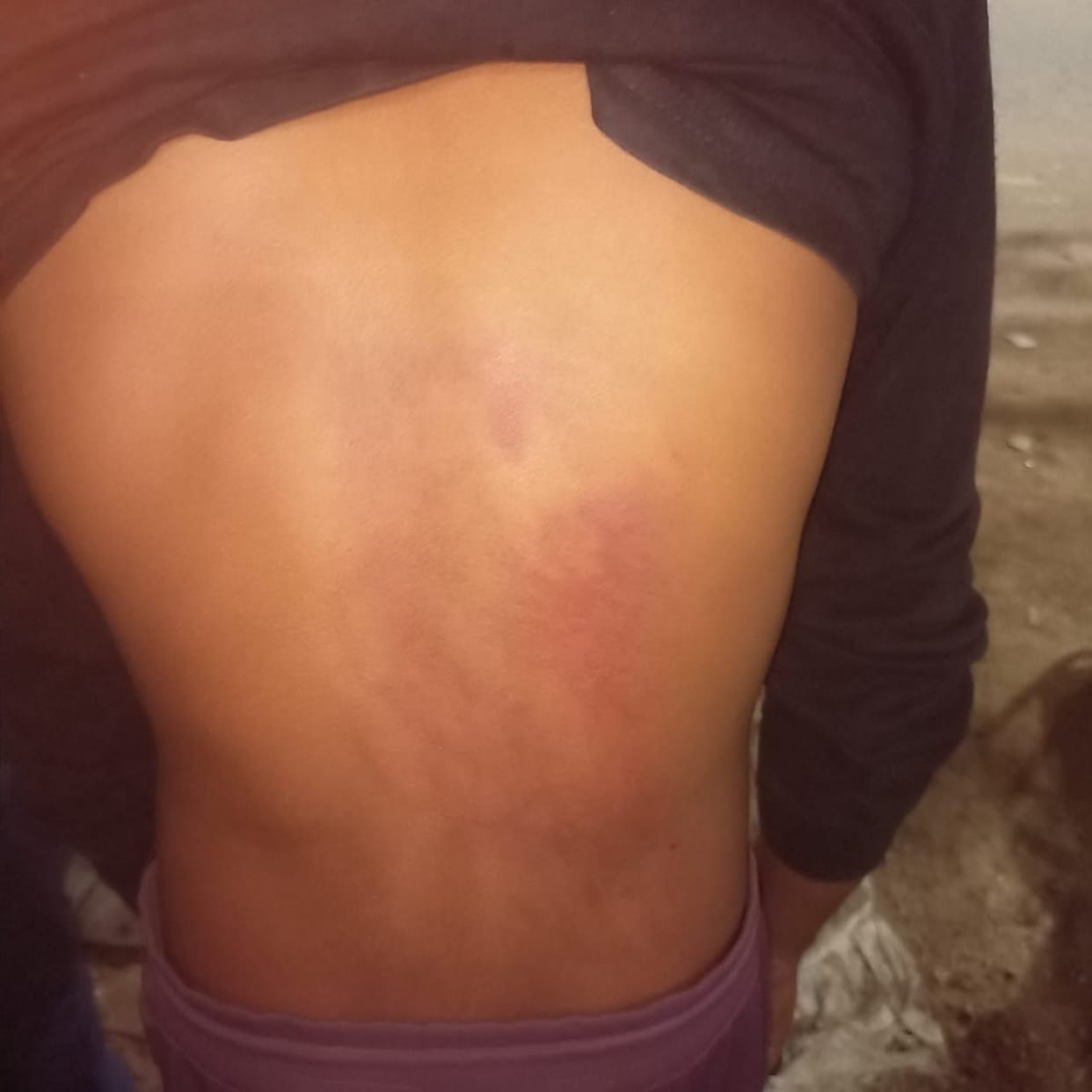 Kanpur Dehat: Teacher beat up student for eating food in class, DIOS removed from school on complaint