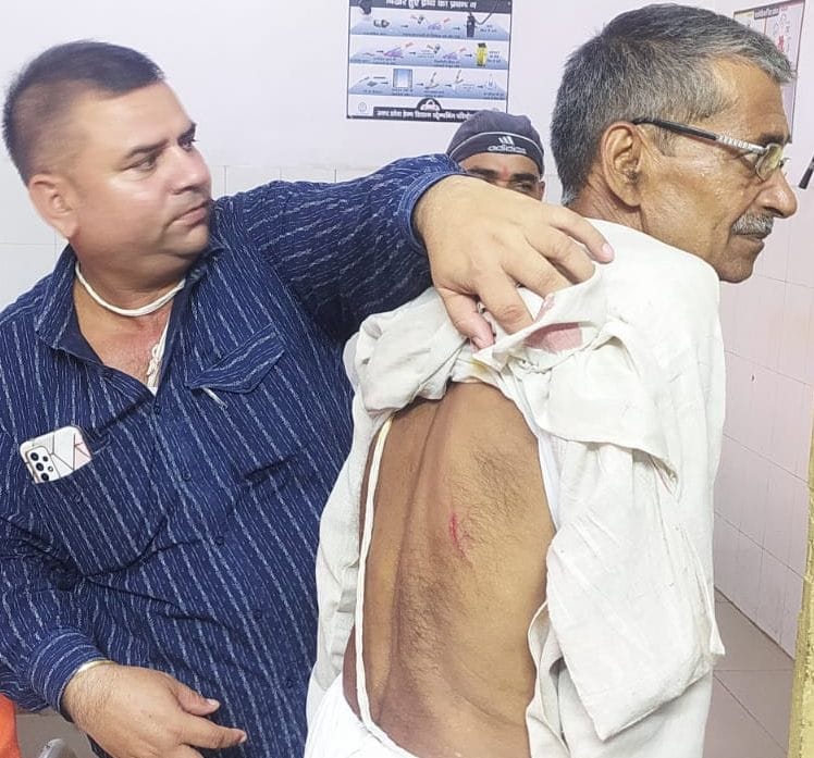 A swarm of monkeys attacked father and son, bled