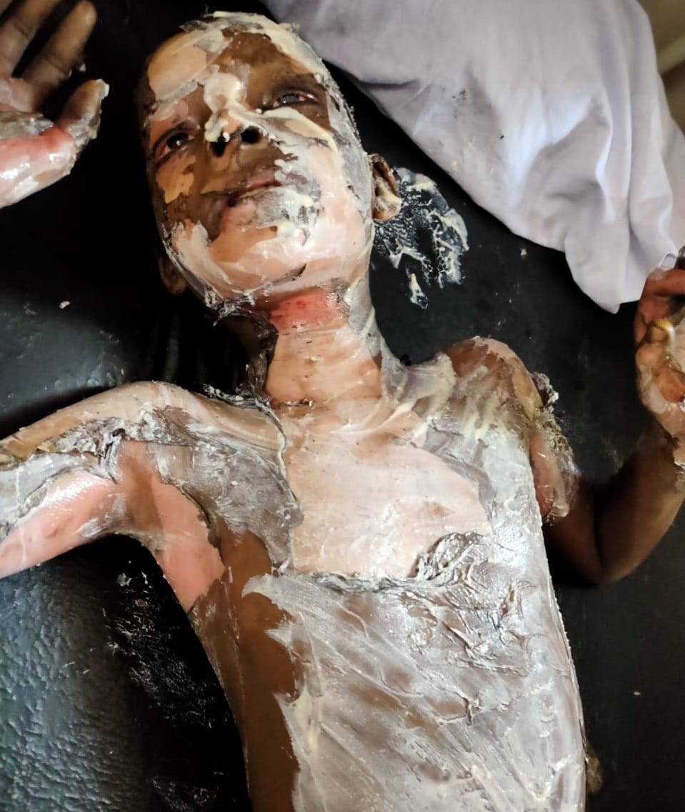 Explosion in fire candle making factory, two killed