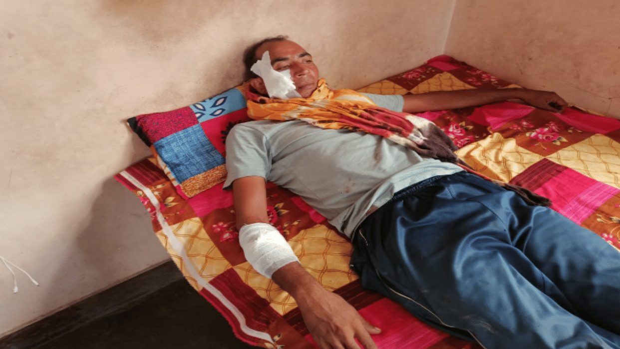 Modipuram: Car rammed inside the shop at high speed, three people including one person, child injured