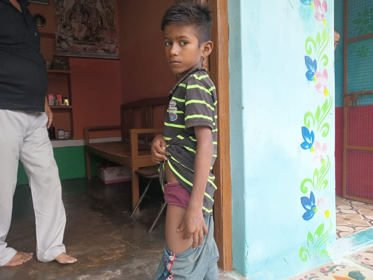 Banda: Many children in the grip of diseases spread in flood affected areas