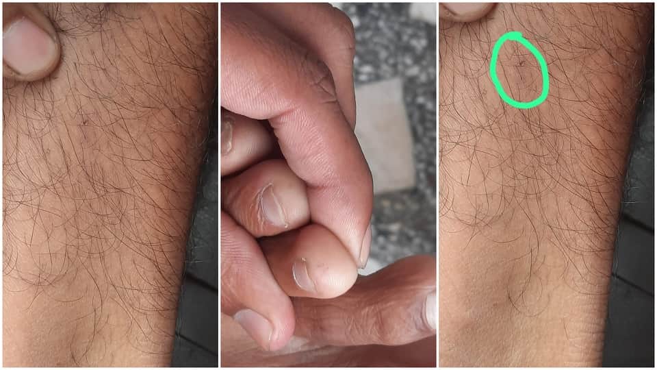 Rajat Chahar bitten by snake Eight time tantriks-treated In Agra Up News