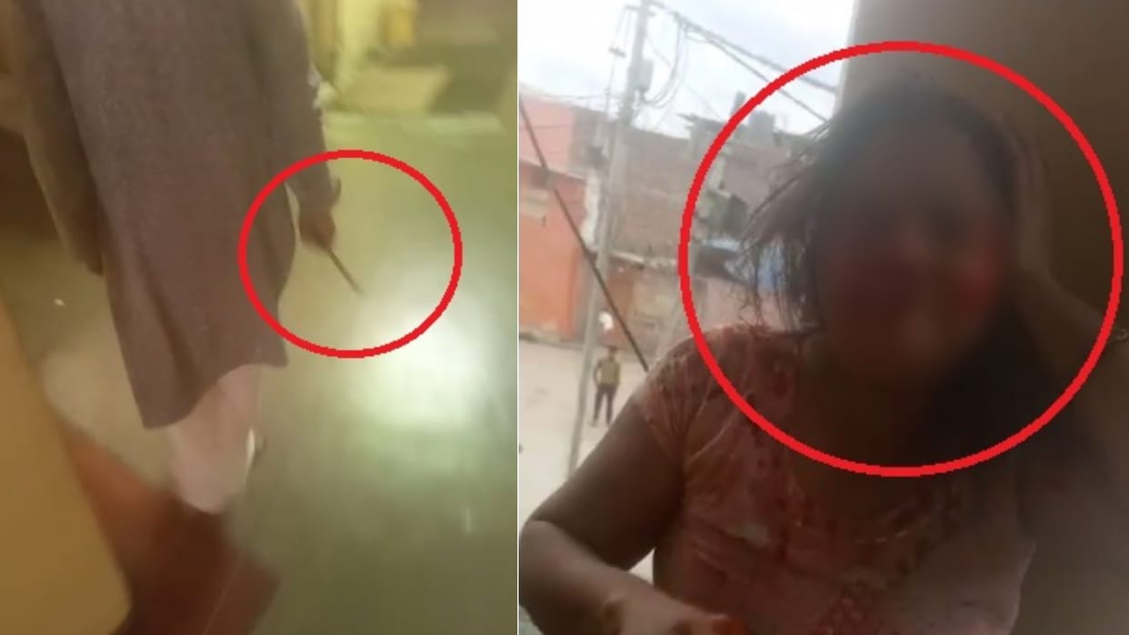 Retired teacher cut off widow daughter-in-law nose in property dispute