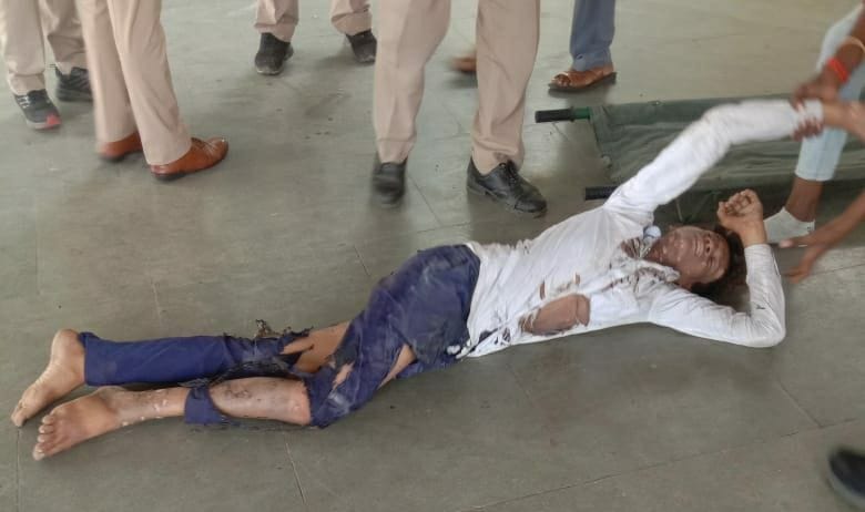 Banda: Student scorched by electric line while taking selfie