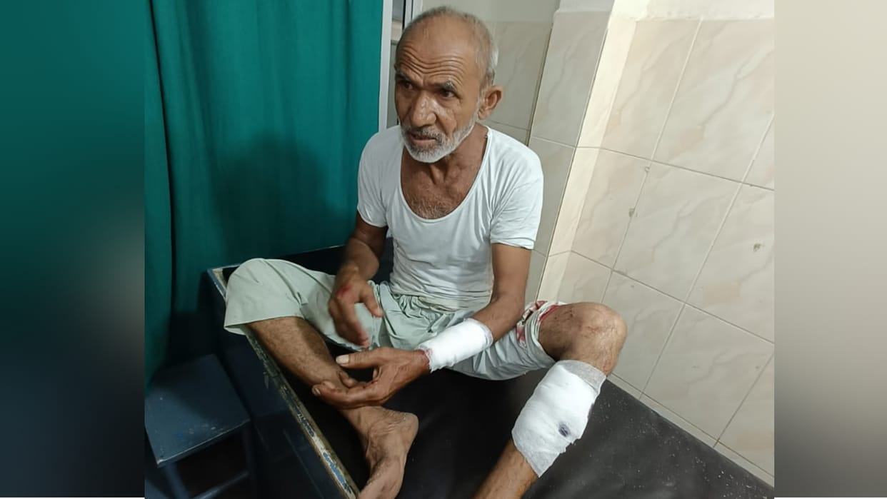 Dog attacked elderly man in Noida got 20 stitches in hands and feet