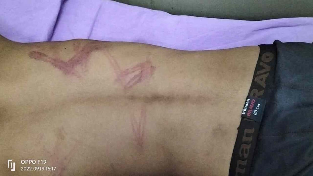 For not paying the fees, the school manager and the principal kicked the student and beat him with sticks.